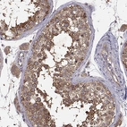 Immunohistochemical staining of human testis shows high expression.