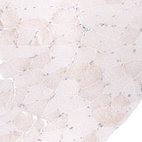 Immunohistochemical staining of human skeletal muscle shows negative to very weak cytoplasmic positivity in myocytes.