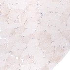 Immunohistochemical staining of human skeletal muscle shows negative to very weak cytoplasmic positivity in myocytes.