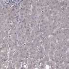 Immunohistochemical staining of human liver shows low expression as expected.
