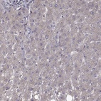 Anti-FARSB Antibody