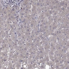 Immunohistochemical staining of human liver shows low expression as expected.