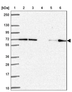 Lane 1: Marker [kDa] 250, 130, 95, 72, 55, 36, 28, 17, 10_br/_Lane 2: Human cell line RT-4_br/_Lane 3: Human cell line U-251 MG_br/_Lane 4: Human plasma_br/_Lane 5: Human Liver tissue_br/_Lane 6: Human Tonsil tissue