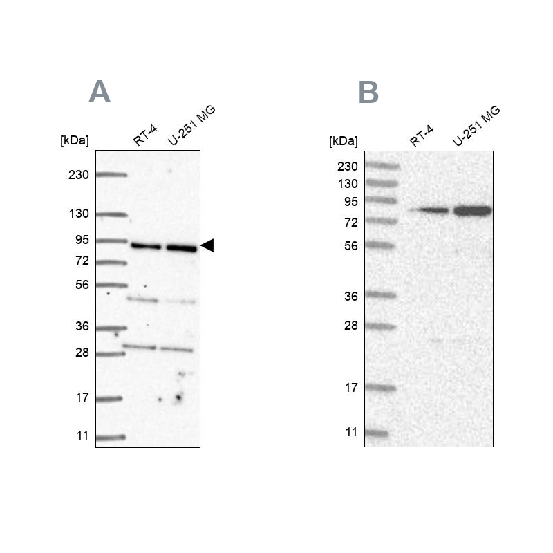 Anti-GFM1 Antibody