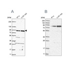 Anti-GFM1 Antibody