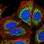 Immunofluorescent staining of human cell line SiHa shows localization to nucleus & mitochondria.