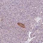 Anti-VWA5B2 Antibody