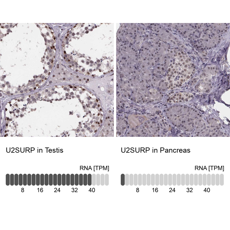 Anti-U2SURP Antibody