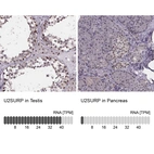 Anti-U2SURP Antibody