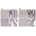 Immunohistochemical staining of human cerebral cortex, colon, liver and testis using Anti-U2SURP antibody HPA061407 (A) shows similar protein distribution across tissues to independent antibody HPA037546 (B).