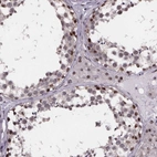 Immunohistochemical staining of human testis shows high expression.