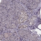 Immunohistochemical staining of human pancreas shows low expression as expected.