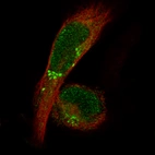 Immunofluorescence staining in RH-30 cell line with Anti-ADAM10 monoclonal antibody, showing specific staining of Golgi apparatus and nucleus in green. Microtubule- and nuclear probes are visualized in red and blue respectively (where available).