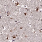 Immunohistochemical staining of human cerebral cortex using Anti-U2SURP antibody HPA061407.