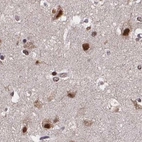 Immunohistochemical staining of human cerebral cortex using Anti-U2SURP antibody HPA061407.
