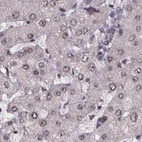 Immunohistochemical staining of human liver using Anti-U2SURP antibody HPA061407.