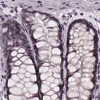 Anti-U2SURP Antibody