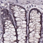 Immunohistochemical staining of human colon using Anti-U2SURP antibody HPA061407.