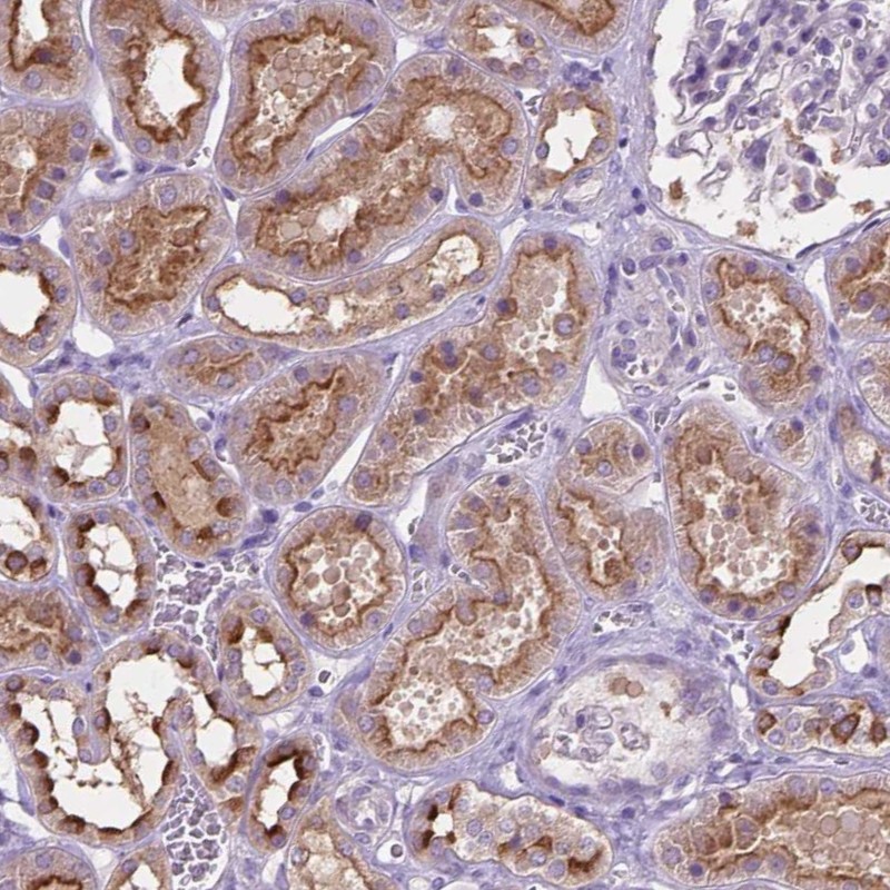 Anti-CDH7 Antibody