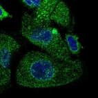 Immunofluorescent staining of human cell line PC-3 shows localization to endoplasmic reticulum.