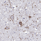 Anti-CALCR Antibody