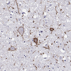 Anti-CALCR Antibody