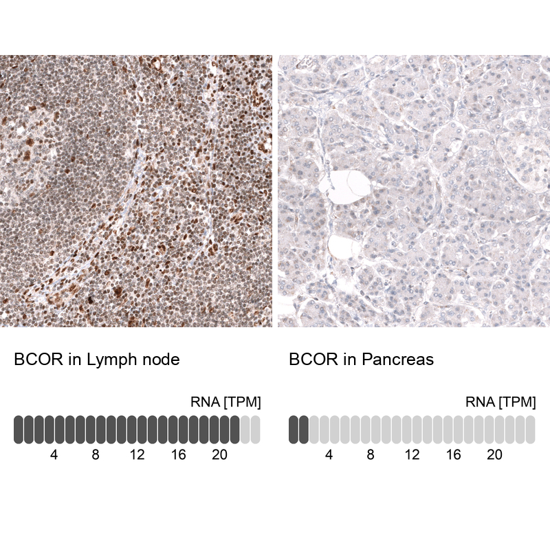 Anti-BCOR Antibody
