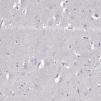 Immunohistochemical staining of human cerebral cortex shows no positivity in neurons as expected.