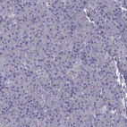Immunohistochemical staining of human pancreas shows no positivity in exocrine glandular cells as expected.