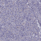 Anti-CALCR Antibody