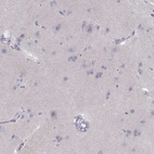 Immunohistochemical staining of human cerebral cortex shows no membranous positivity in neurons as expected.