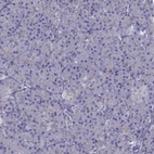 Immunohistochemical staining of human pancreas shows no membranous positivity in exocrine glandular cells as expected.