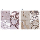 Immunohistochemical staining of human cerebral cortex, colon, skeletal muscle and thyroid gland using Anti-GANAB antibody HPA061426 (A) shows similar protein distribution across tissues to independent antibody HPA026874 (B).
