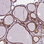 Immunohistochemical staining of human thyroid gland shows high expression.