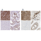 Immunohistochemical staining of human heart muscle, kidney, liver and testis using Anti-OXCT1 antibody HPA061425 (A) shows similar protein distribution across tissues to independent antibody HPA012047 (B).