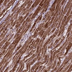 Immunohistochemical staining of human heart muscle shows strong cytoplasmic positivity in cardiomyocytes.