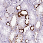 Immunohistochemical staining of human kidney shows strong cytoplasmic positivity in cells in tubules.