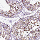 Immunohistochemical staining of human testis shows strong cytoplasmic positivity in cells in seminiferous ducts.