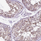 Immunohistochemical staining of human testis shows strong cytoplasmic positivity in cells in seminiferous ducts.