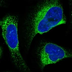 Immunofluorescent staining of human cell line U-2 OS shows localization to endoplasmic reticulum.