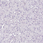 Anti-OXCT1 Antibody