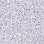 Immunohistochemical staining of human liver shows no positivity in hepatocytes as expected.