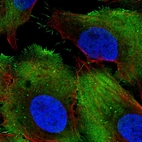 Anti-PCMTD1 Antibody