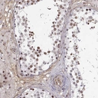 Anti-CIR1 Antibody