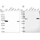 Anti-LPXN Antibody