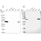 Western blot analysis using Anti-LPXN antibody HPA061441 (A) shows similar pattern to independent antibody HPA043741 (B).