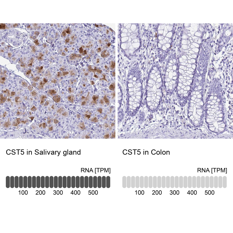Anti-CST5 Antibody
