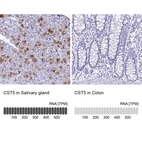 Anti-CST5 Antibody