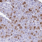 Anti-CST5 Antibody