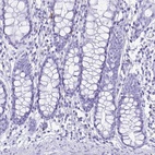 Anti-CST5 Antibody